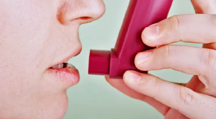 Xông hơi/xịt họng có giúp giọng bền không là thắc mắc của nhiều người